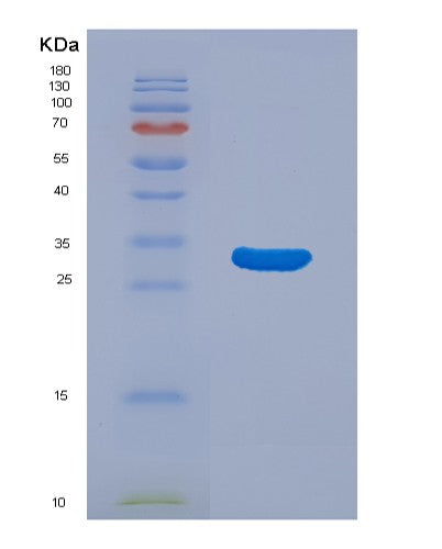 SDS-PAGE analysis of Human MAP2K3 (Dual Specificity Mitogen-Activated Protein Kinase Kinase 3) - Recombinant Protein, CATHuman MAP2K3 (Dual Specificity Mitogen-Activated Protein Kinase Kinase 3) - Recombinant Protein