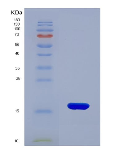 SDS-PAGE analysis of Human CASP9 (Caspase-9) - Recombinant Protein, CAT# BLT-07649P, showing >90% purity under 15% SDS-PAGE (Reduced)Human CASP9 (Caspase-9) - Recombinant Protein