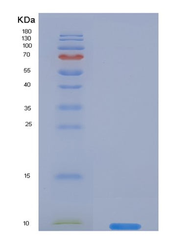 SDS-PAGE analysis of Human SERPINB4 (Serpin B4) - Recombinant Protein, CAT# BLT-02743P, showing >95% purity under 15% SDS-PAGE (Reduced)Human SERPINB4 (Serpin B4) - Recombinant Protein