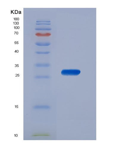 SDS-PAGE analysis of Human CSNK1A1 (Casein Kinase I Isoform Alpha) - Recombinant Protein, CAT# BLT-00720P, showing >90% purity under 15% SDS-PAGE (Reduced)Human CSNK1A1 (Casein Kinase I Isoform Alpha) - Recombinant Protein