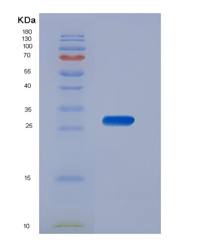 SDS-PAGE analysis of Human CSNK1A1 (Casein Kinase I Isoform Alpha) - Recombinant Protein, CATHuman CSNK1A1 (Casein Kinase I Isoform Alpha) - Recombinant Protein