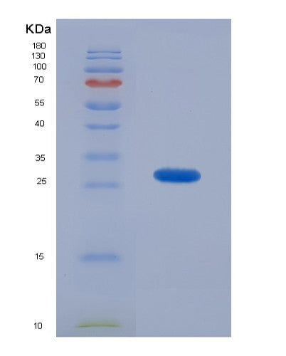 SDS-PAGE analysis of Human CAMLG (Guided Entry Of Tail-Anchored Proteins Factor Camlg) - Recombinant Protein, CATHuman CAMLG (Guided Entry Of Tail-Anchored Proteins Factor Camlg) - Recombinant Protein