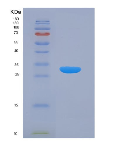 SDS-PAGE analysis of Human ARRB1 (Beta-Arrestin-1) - Recombinant Protein, CAT# BLT-04254P, showing >90% purity under 15% SDS-PAGE (Reduced)Human ARRB1 (Beta-Arrestin-1) - Recombinant Protein