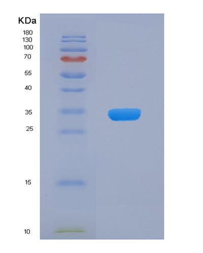 SDS-PAGE analysis of Human CDC34 (Ubiquitin-Conjugating Enzyme E2 R1) - Recombinant Protein, CAT# BLT-00530P, showing >90% purity under 15% SDS-PAGE (Reduced)Human CDC34 (Ubiquitin-Conjugating Enzyme E2 R1) - Recombinant Protein