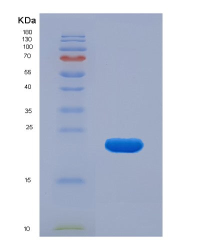 SDS-PAGE analysis of Mouse Alox5 (Polyunsaturated Fatty Acid 5-Lipoxygenase) - Recombinant Protein, CATMouse Alox5 (Polyunsaturated Fatty Acid 5-Lipoxygenase) - Recombinant Protein