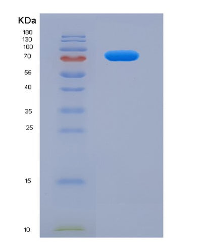 SDS-PAGE analysis of Human ALOX5 (Polyunsaturated Fatty Acid 5-Lipoxygenase) - Recombinant Protein, CAT# BLT-07651P, showing >90% purity under 15% SDS-PAGE (Reduced)Human ALOX5 (Polyunsaturated Fatty Acid 5-Lipoxygenase) - Recombinant Protein