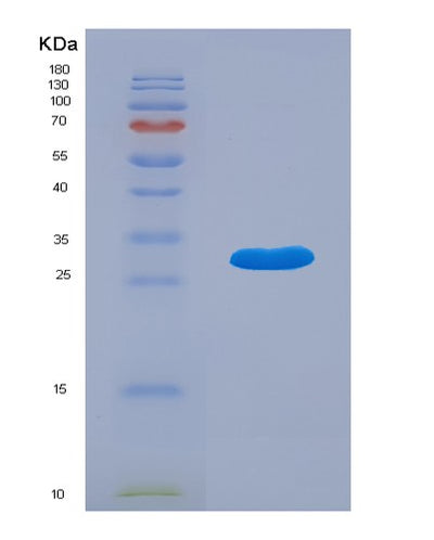 SDS-PAGE analysis of Human ACADVL (Very Long-Chain Specific Acyl-Coa Dehydrogenase, Mitochondrial) - Recombinant Protein, CAT# BLT-00029P, showing >90% purity under 15% SDS-PAGE (Reduced)Human ACADVL (Very Long-Chain Specific Acyl-Coa Dehydrogenase, Mitochondrial) - Recombinant Protein