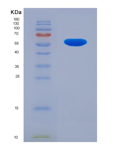 SDS-PAGE analysis of Human RARRES1 (Retinoic Acid Receptor Responder Protein 1) - Recombinant Protein, CATHuman RARRES1 (Retinoic Acid Receptor Responder Protein 1) - Recombinant Protein