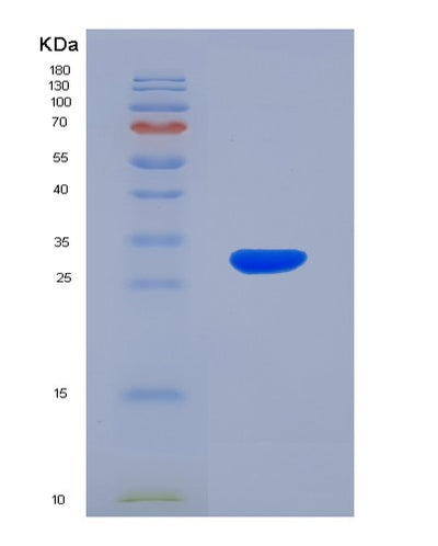 SDS-PAGE analysis of Human RGS19 (Regulator Of G-Protein Signaling 19) - Recombinant Protein, CAT# BLT-02573P, showing >90% purity under 15% SDS-PAGE (Reduced)Human RGS19 (Regulator Of G-Protein Signaling 19) - Recombinant Protein