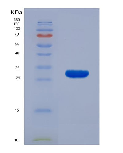 SDS-PAGE analysis of Human KLK7 (Kallikrein-7) - Recombinant Protein, CAT# BLT-01650P, showing >90% purity under 15% SDS-PAGE (Reduced)Human KLK7 (Kallikrein-7) - Recombinant Protein