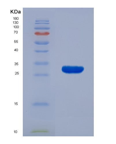 SDS-PAGE analysis of Human KLK7 (Kallikrein-7) - Recombinant Protein, CATHuman KLK7 (Kallikrein-7) - Recombinant Protein