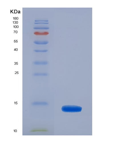 SDS-PAGE analysis of Human CRIP1 (Cysteine-Rich Protein 1) - Recombinant Protein, CAT# BLT-00690P, showing >90% purity under 15% SDS-PAGE (Reduced)Human CRIP1 (Cysteine-Rich Protein 1) - Recombinant Protein
