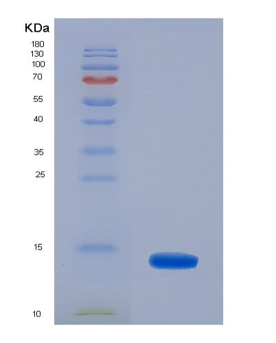 SDS-PAGE analysis of Human CRIP1 (Cysteine-Rich Protein 1) - Recombinant Protein, CATHuman CRIP1 (Cysteine-Rich Protein 1) - Recombinant Protein