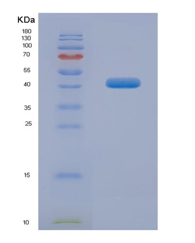 SDS-PAGE analysis of Human MAPT (Microtubule-Associated Protein Tau) - Recombinant Protein, CAT# BLT-07652P, showing >90% purity under 15% SDS-PAGE (Reduced)Human MAPT (Microtubule-Associated Protein Tau) - Recombinant Protein