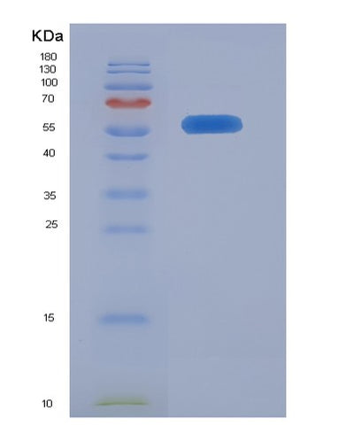 SDS-PAGE analysis of Human ANXA11 (Annexin A11) - Recombinant Protein, CAT# BLT-00172P, showing >85% purity under 15% SDS-PAGE (Reduced)Human ANXA11 (Annexin A11) - Recombinant Protein