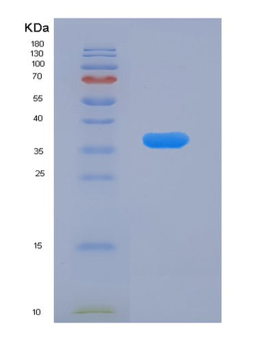 SDS-PAGE analysis of Human RAB7A (Ras-Related Protein Rab-7A) - Recombinant Protein, CAT# BLT-02495P, showing >90% purity under 15% SDS-PAGE (Reduced)Human RAB7A (Ras-Related Protein Rab-7A) - Recombinant Protein