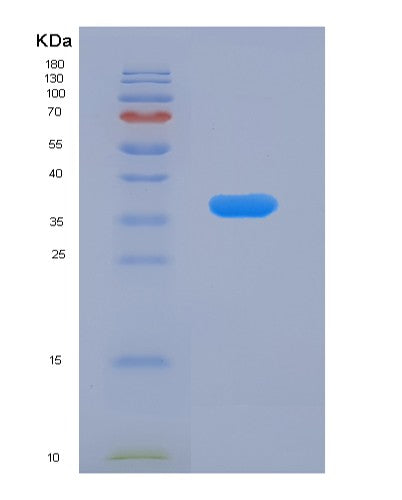 SDS-PAGE analysis of Human RAB7A (Ras-Related Protein Rab-7A) - Recombinant Protein, CATHuman RAB7A (Ras-Related Protein Rab-7A) - Recombinant Protein
