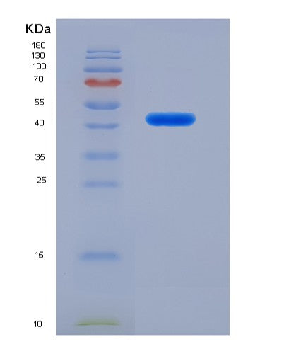 SDS-PAGE analysis of Human DAP (Death-Associated Protein 1) - Recombinant Protein, CATHuman DAP (Death-Associated Protein 1) - Recombinant Protein