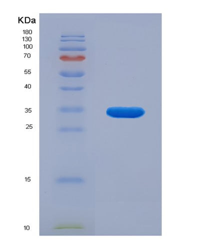 SDS-PAGE analysis of Human SERPINA7 (Thyroxine-Binding Globulin) - Recombinant Protein, CAT# BLT-07654P, showing >90% purity under 15% SDS-PAGE (Reduced)Human SERPINA7 (Thyroxine-Binding Globulin) - Recombinant Protein