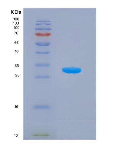 SDS-PAGE analysis of Mouse Glrx3 (Glutaredoxin-3) - Recombinant Protein, CAT# BLT-07655P, showing >90% purity under 15% SDS-PAGE (Reduced)Mouse Glrx3 (Glutaredoxin-3) - Recombinant Protein