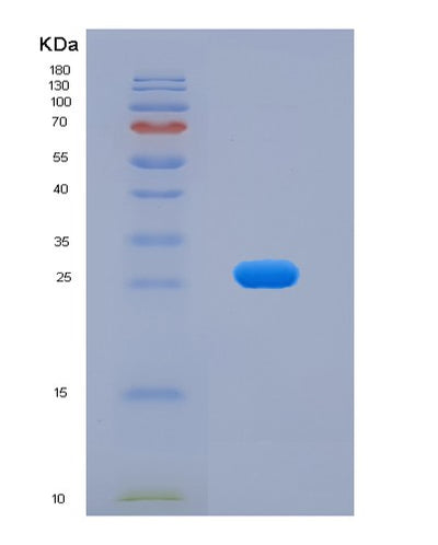 SDS-PAGE analysis of Mouse Fap (Prolyl Endopeptidase Fap) - Recombinant Protein, CAT# BLT-07658P, showing >90% purity under 15% SDS-PAGE (Reduced)Mouse Fap (Prolyl Endopeptidase Fap) - Recombinant Protein