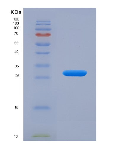 SDS-PAGE analysis of Human BLK (Tyrosine-Protein Kinase Blk) - Recombinant Protein, CATHuman BLK (Tyrosine-Protein Kinase Blk) - Recombinant Protein