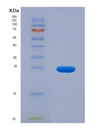 SDS-PAGE analysis of Mouse Ccl9 (C-C Motif Chemokine 9) - Recombinant Protein, CATMouse Ccl9 (C-C Motif Chemokine 9) - Recombinant Protein