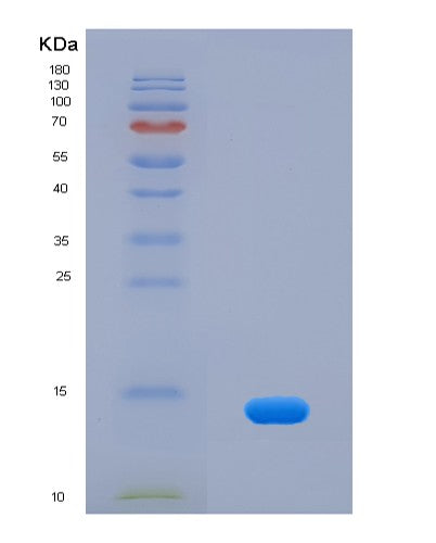SDS-PAGE analysis of Human CCL11 (Eotaxin) - Recombinant Protein, CATHuman CCL11 (Eotaxin) - Recombinant Protein