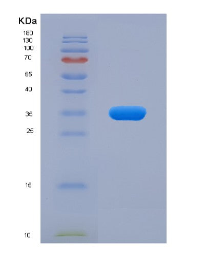 SDS-PAGE analysis of Human STAT5B (Signal Transducer And Activator Of Transcription 5B) - Recombinant Protein, CATHuman STAT5B (Signal Transducer And Activator Of Transcription 5B) - Recombinant Protein