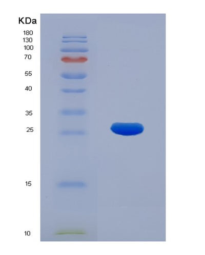 SDS-PAGE analysis of Human KPNA2 (Importin Subunit Alpha-1) - Recombinant Protein, CAT# BLT-01657P, showing >85% purity under 15% SDS-PAGE (Reduced)Human KPNA2 (Importin Subunit Alpha-1) - Recombinant Protein