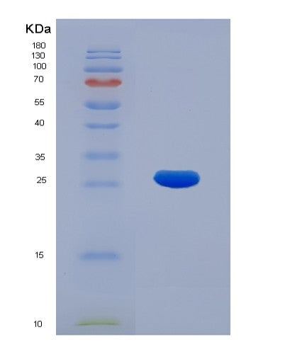 SDS-PAGE analysis of Human KPNA2 (Importin Subunit Alpha-1) - Recombinant Protein, CATHuman KPNA2 (Importin Subunit Alpha-1) - Recombinant Protein