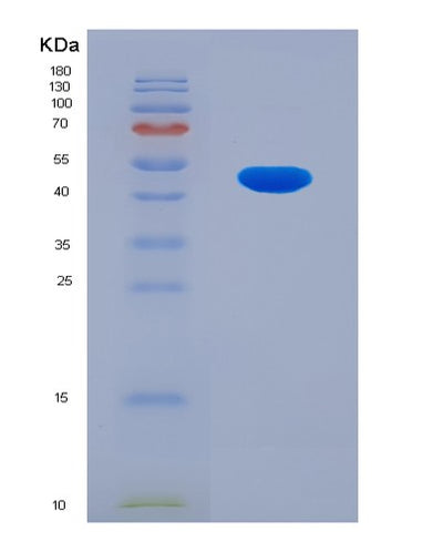 SDS-PAGE analysis of Human ARHGDIB (Rho Gdp-Dissociation Inhibitor 2) - Recombinant Protein, CAT# BLT-00207P, showing >85% purity under 15% SDS-PAGE (Reduced)Human ARHGDIB (Rho Gdp-Dissociation Inhibitor 2) - Recombinant Protein