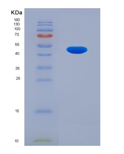 SDS-PAGE analysis of Human ARHGDIB (Rho Gdp-Dissociation Inhibitor 2) - Recombinant Protein, CATHuman ARHGDIB (Rho Gdp-Dissociation Inhibitor 2) - Recombinant Protein