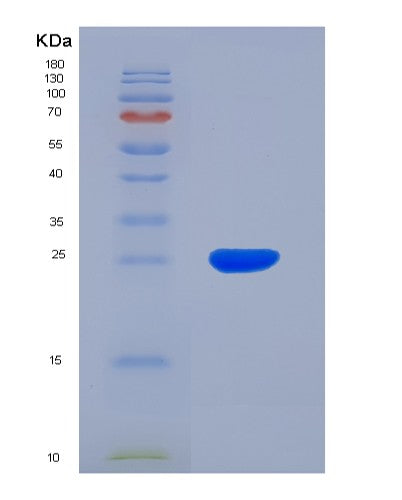 SDS-PAGE analysis of Human HK2 (Hexokinase-2) - Recombinant Protein, CATHuman HK2 (Hexokinase-2) - Recombinant Protein