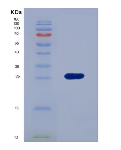 SDS-PAGE analysis of Human EFNA3 (Ephrin-A3) - Recombinant Protein, CAT# BLT-00939P, showing >95% purity under 15% SDS-PAGE (Reduced)Human EFNA3 (Ephrin-A3) - Recombinant Protein