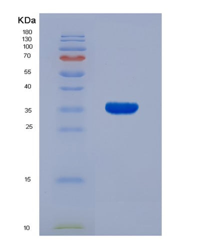 SDS-PAGE analysis of Human EFNB2 (Ephrin-B2) - Recombinant Protein, CAT# BLT-00942P, showing >95% purity under 15% SDS-PAGE (Reduced)Human EFNB2 (Ephrin-B2) - Recombinant Protein