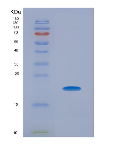 SDS-PAGE analysis of Human THOP1 (Thimet Oligopeptidase) - Recombinant Protein, CAT# BLT-04498P, showing >90% purity under 15% SDS-PAGE (Reduced)Human THOP1 (Thimet Oligopeptidase) - Recombinant Protein