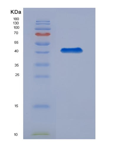 SDS-PAGE analysis of Human AKR1C2 (Aldo-Keto Reductase Family 1 Member C2) - Recombinant Protein, CAT# BLT-04672P, showing >90% purity under 15% SDS-PAGE (Reduced)Human AKR1C2 (Aldo-Keto Reductase Family 1 Member C2) - Recombinant Protein
