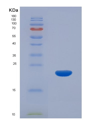 SDS-PAGE analysis of Human CEBPG (Ccaat/Enhancer-Binding Protein Gamma) - Recombinant Protein, CATHuman CEBPG (Ccaat/Enhancer-Binding Protein Gamma) - Recombinant Protein