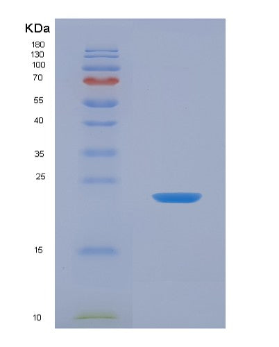 SDS-PAGE analysis of Human TNFSF13B (Tumor Necrosis Factor Ligand Superfamily Member 13B) - Recombinant Protein, CATHuman TNFSF13B (Tumor Necrosis Factor Ligand Superfamily Member 13B) - Recombinant Protein