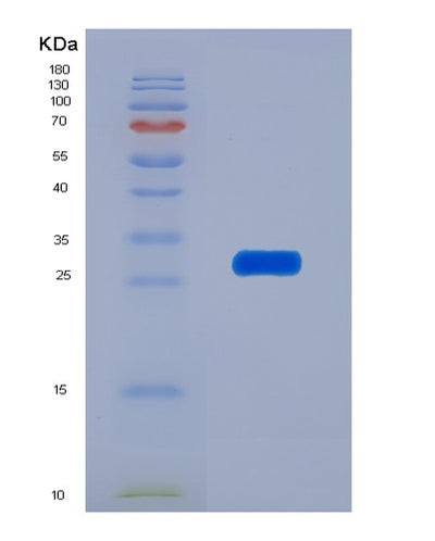 SDS-PAGE analysis of Human CHRNA1 (Acetylcholine Receptor Subunit Alpha) - Recombinant Protein, CAT# BLT-07662P, showing >90% purity under 15% SDS-PAGE (Reduced)Human CHRNA1 (Acetylcholine Receptor Subunit Alpha) - Recombinant Protein