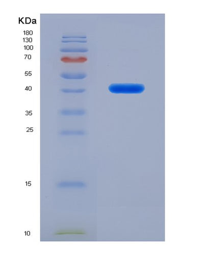 SDS-PAGE analysis of Human OAZ1 (Ornithine Decarboxylase Antizyme 1) - Recombinant Protein, CAT# BLT-02107P, showing >95% purity under 15% SDS-PAGE (Reduced)Human OAZ1 (Ornithine Decarboxylase Antizyme 1) - Recombinant Protein