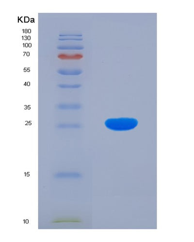 SDS-PAGE analysis of Human BCAT1 (Branched-Chain-Amino-Acid Aminotransferase, Cytosolic) - Recombinant Protein, CAT# BLT-00293P, showing >85% purity under 15% SDS-PAGE (Reduced)Human BCAT1 (Branched-Chain-Amino-Acid Aminotransferase, Cytosolic) - Recombinant Protein