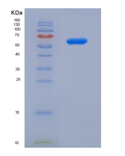 SDS-PAGE analysis of Human ANXA5 (Annexin A5) - Recombinant Protein, CAT# BLT-07665P, showing >90% purity under 15% SDS-PAGE (Reduced)Human ANXA5 (Annexin A5) - Recombinant Protein