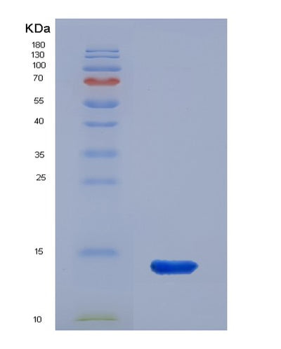 SDS-PAGE analysis of Mouse Ucp1 (Mitochondrial Brown Fat Uncoupling Protein 1) - Recombinant Protein, CAT# BLT-07666P, showing >90% purity under 15% SDS-PAGE (Reduced)Mouse Ucp1 (Mitochondrial Brown Fat Uncoupling Protein 1) - Recombinant Protein