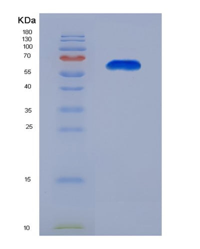 SDS-PAGE analysis of Human CFTR (Cystic Fibrosis Transmembrane Conductance Regulator) - Recombinant Protein, CAT# BLT-07667P, showing >90% purity under 15% SDS-PAGE (Reduced)Human CFTR (Cystic Fibrosis Transmembrane Conductance Regulator) - Recombinant Protein