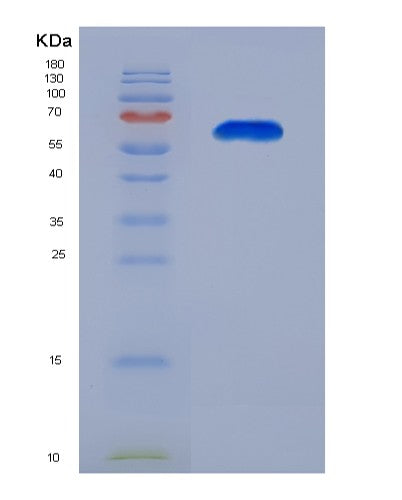 SDS-PAGE analysis of Human CFTR (Cystic Fibrosis Transmembrane Conductance Regulator) - Recombinant Protein, CATHuman CFTR (Cystic Fibrosis Transmembrane Conductance Regulator) - Recombinant Protein