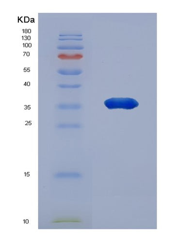 SDS-PAGE analysis of Human NAPA (Alpha-Soluble Nsf Attachment Protein) - Recombinant Protein, CAT# BLT-01967P, showing >90% purity under 15% SDS-PAGE (Reduced)Human NAPA (Alpha-Soluble Nsf Attachment Protein) - Recombinant Protein