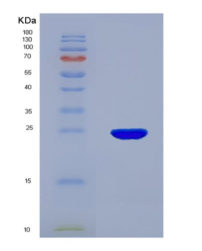 SDS-PAGE analysis of Mouse Cdo1 (Cysteine Dioxygenase Type 1) - Recombinant Protein, CAT# BLT-07668P, showing >90% purity under 15% SDS-PAGE (Reduced)Mouse Cdo1 (Cysteine Dioxygenase Type 1) - Recombinant Protein