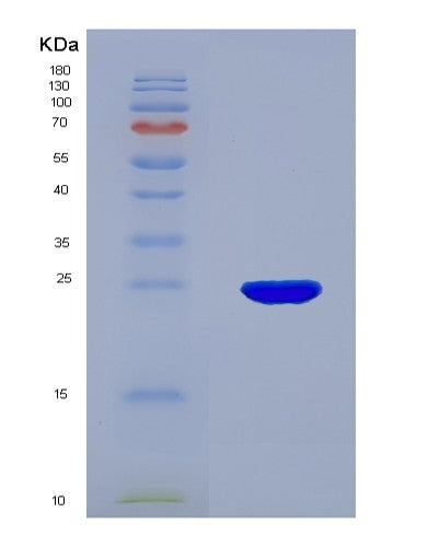 SDS-PAGE analysis of Mouse Cdo1 (Cysteine Dioxygenase Type 1) - Recombinant Protein, CATMouse Cdo1 (Cysteine Dioxygenase Type 1) - Recombinant Protein